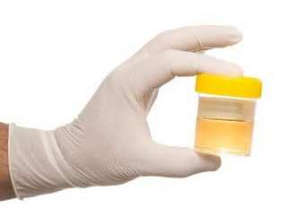 urine_sample_drug-test_agathos_labs